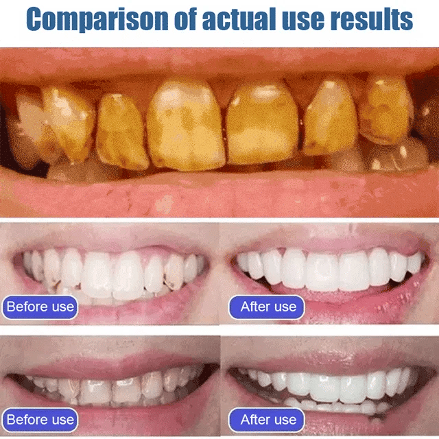 teeth whitening toothpaste
