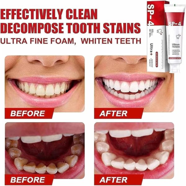 teeth whitening toothpaste