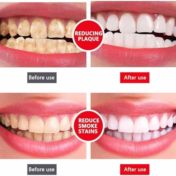 teeth whitening toothpaste