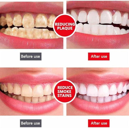 teeth whitening toothpaste